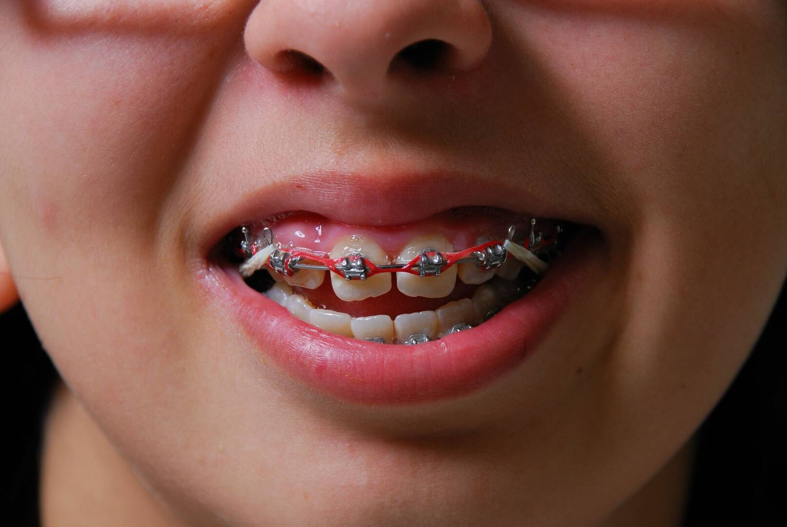 Denture Service Grand Rapids MI
