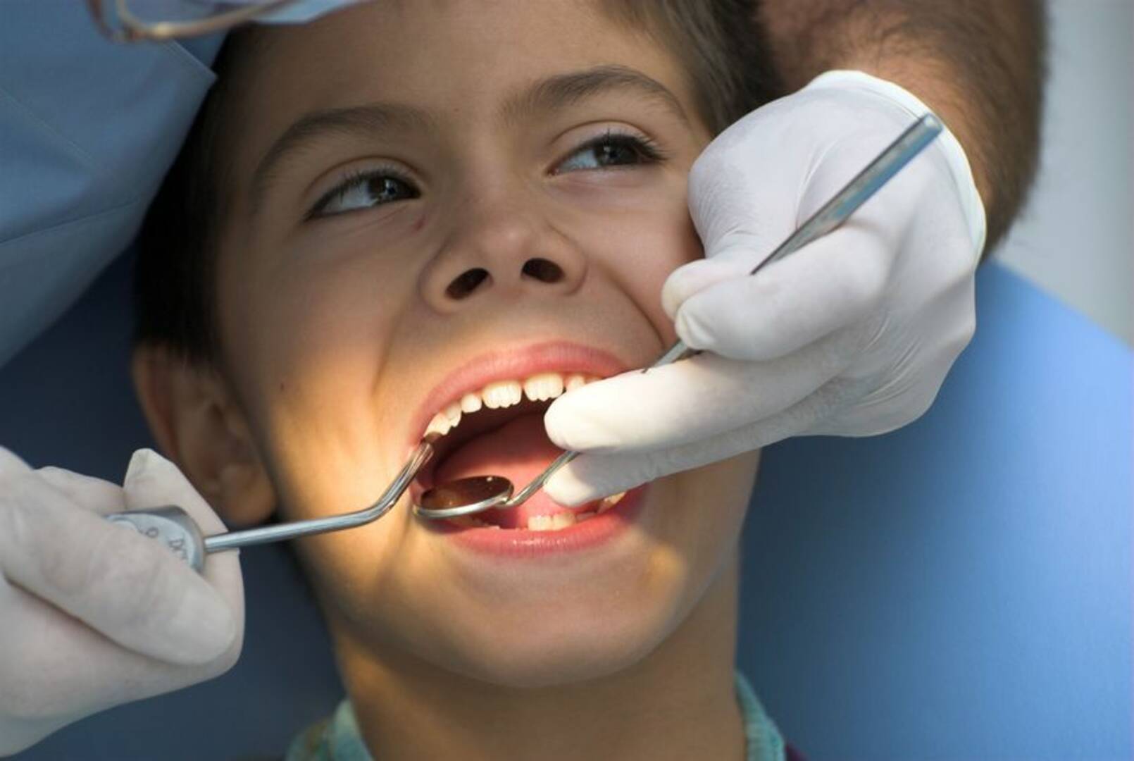 Teeth Whitening Andover Mn
